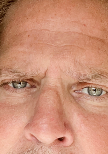 Todd78